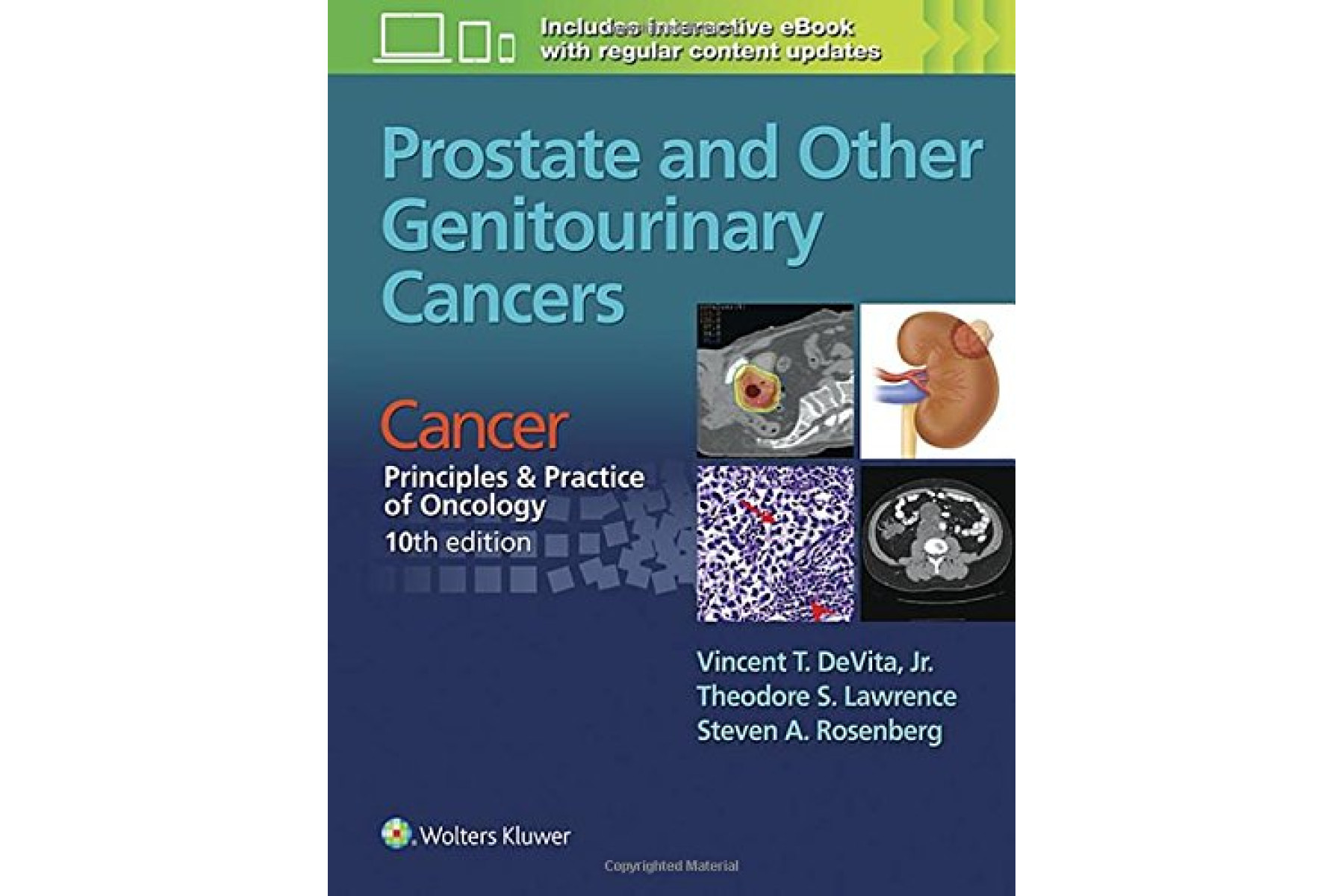 Prostate and Other Genitourinary Cancers: From Cancer: Principles & Practice of Oncology, 10th editi