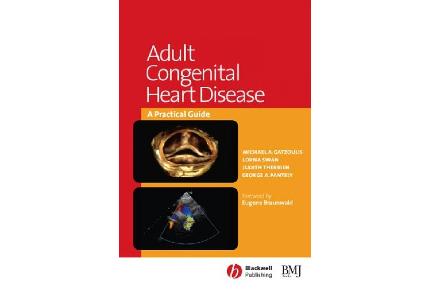 Adult Congenital Heart Disease: a Practical Guide