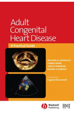 Adult Congenital Heart Disease: a Practical Guide