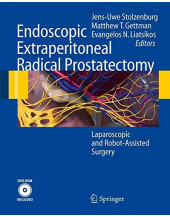 Endoscopic Extraperitoneal Radical Prostatectomy: Laparoscopic and Robot-Assisted Surgery