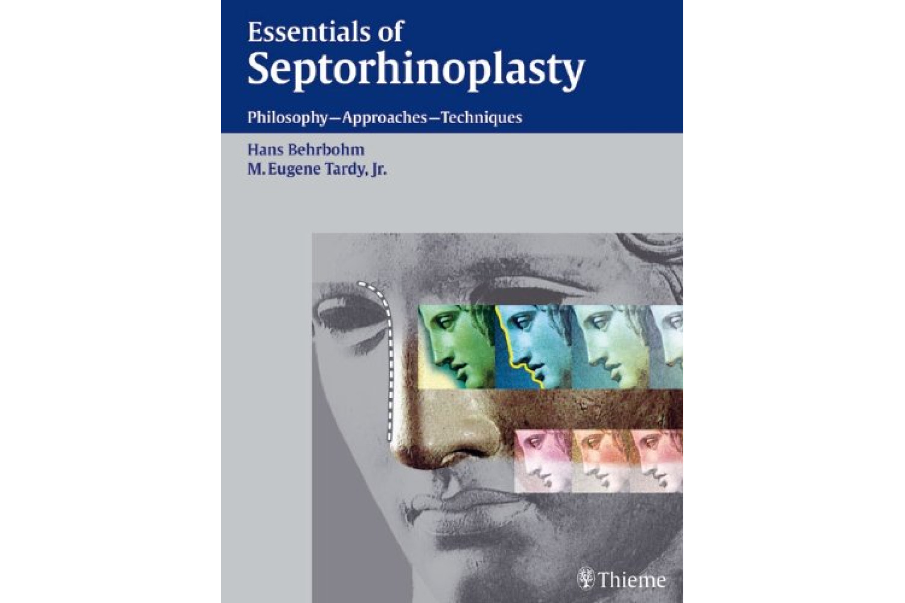 Essentials of Septorhinoplasty
