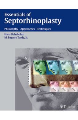 Essentials of Septorhinoplasty