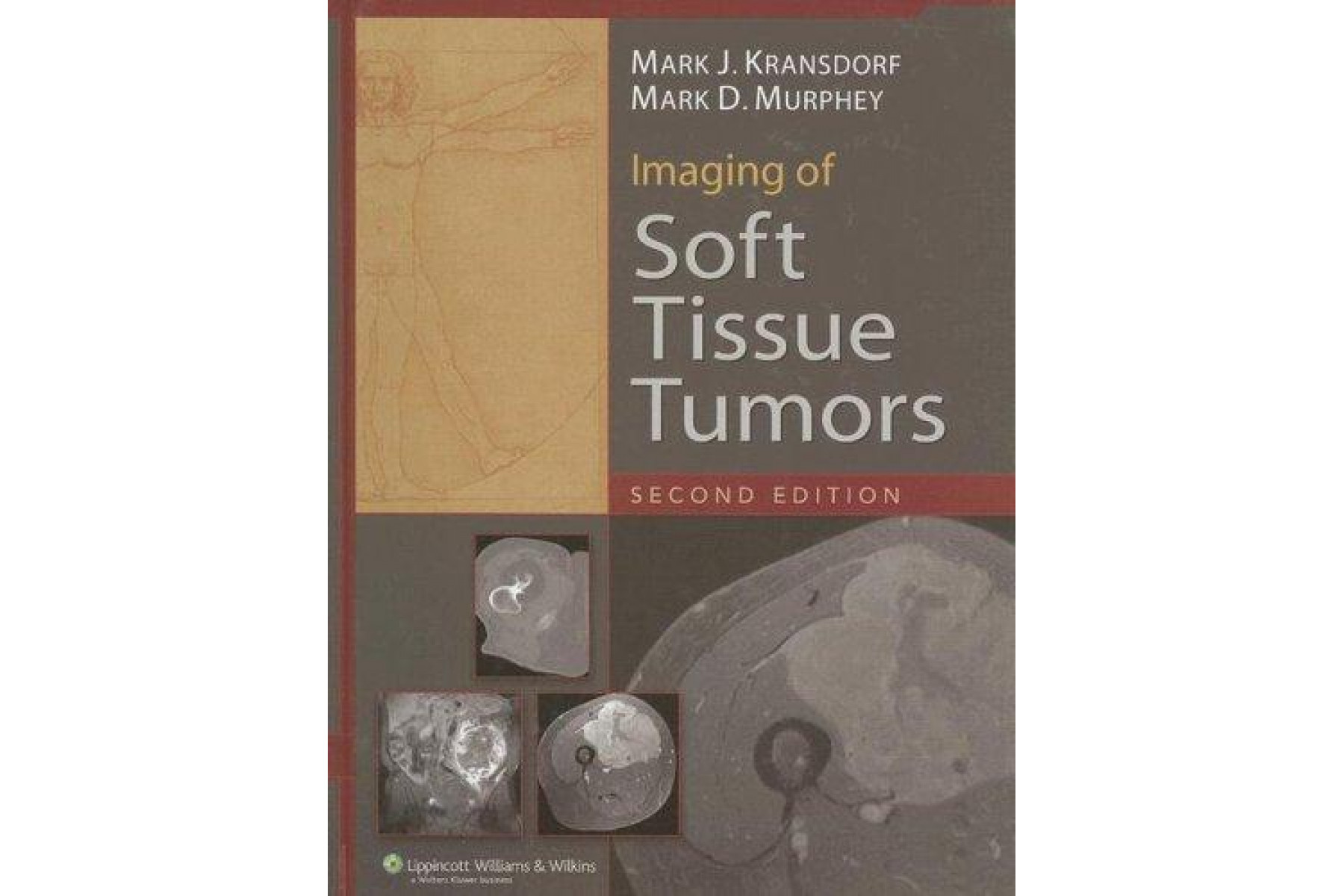 Imaging of Soft Tissue Tumors