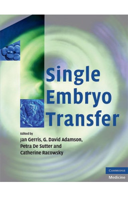 Single Embryo Transfer