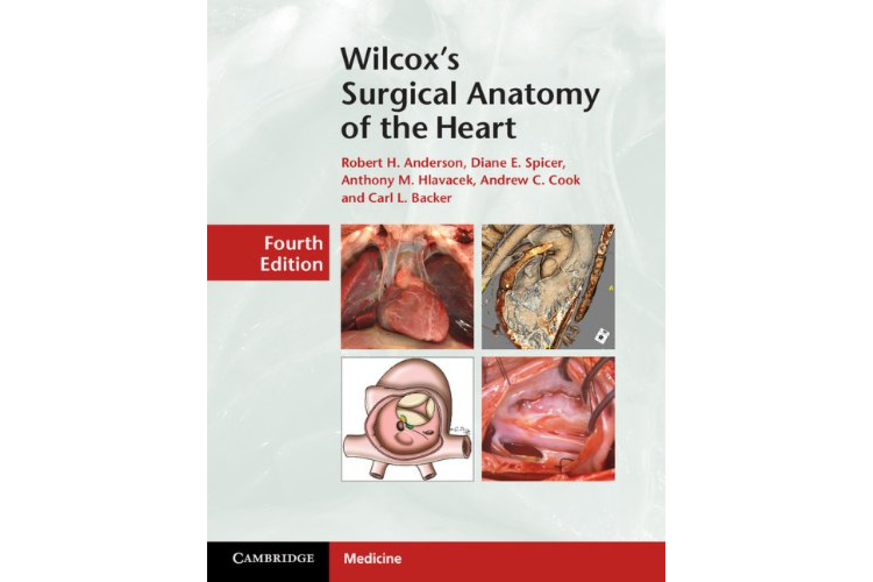 Wilcox's Surgical Anatomy of the Heart