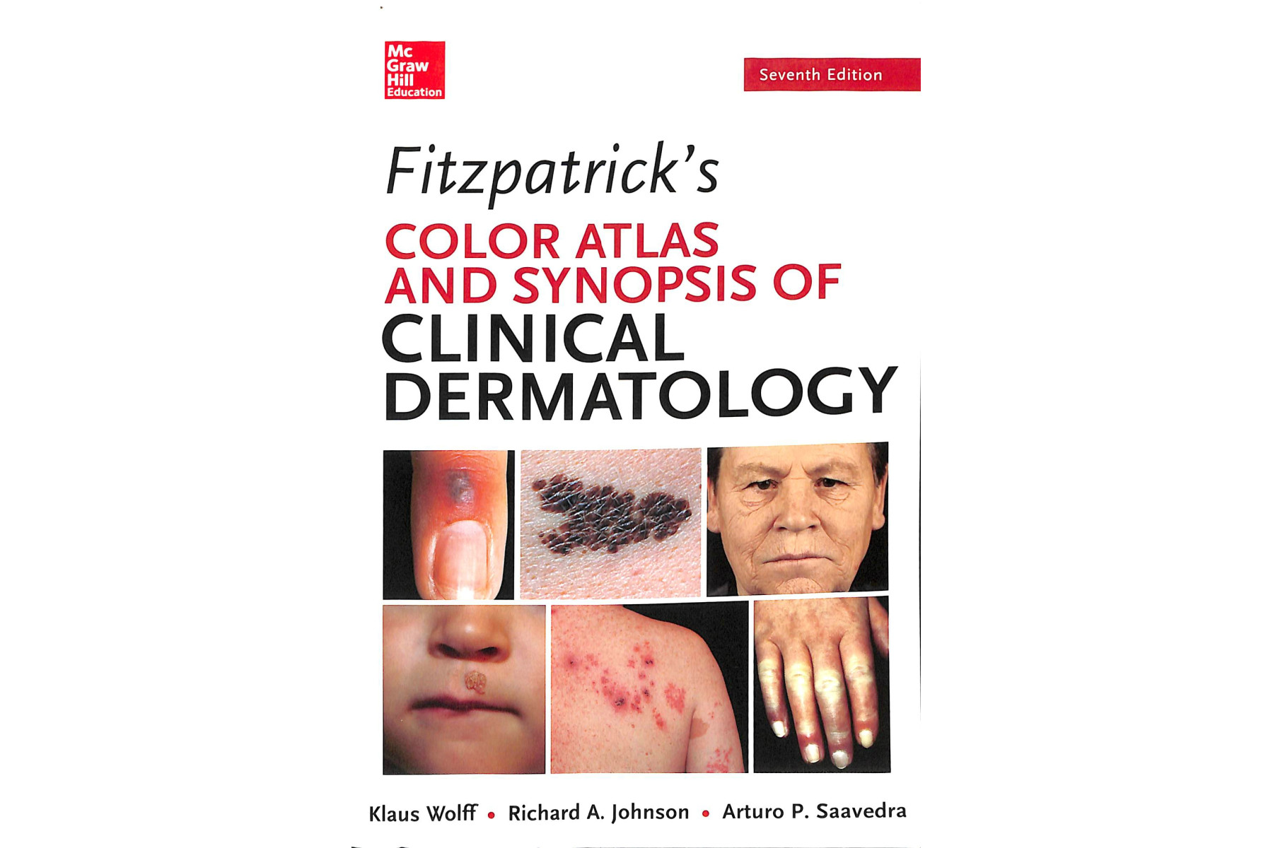 Fitzpatrick's Color Atlas and Synopsis of Clinical Dermatology, Seventh Edition