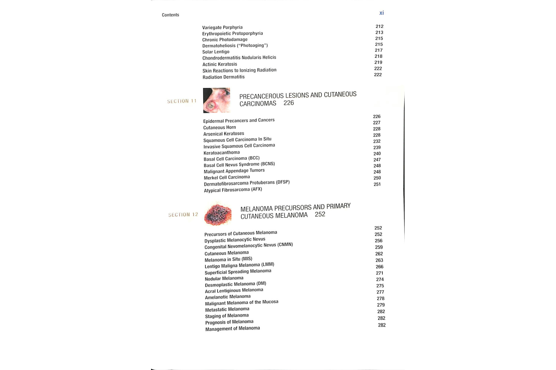 Fitzpatrick's Color Atlas and Synopsis of Clinical Dermatology, Seventh Edition