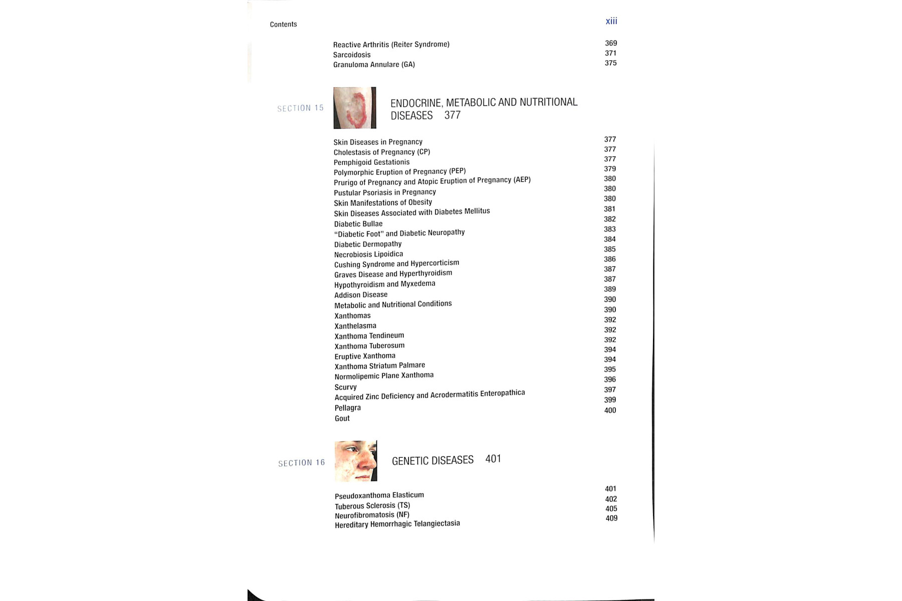 Fitzpatrick's Color Atlas and Synopsis of Clinical Dermatology, Seventh Edition