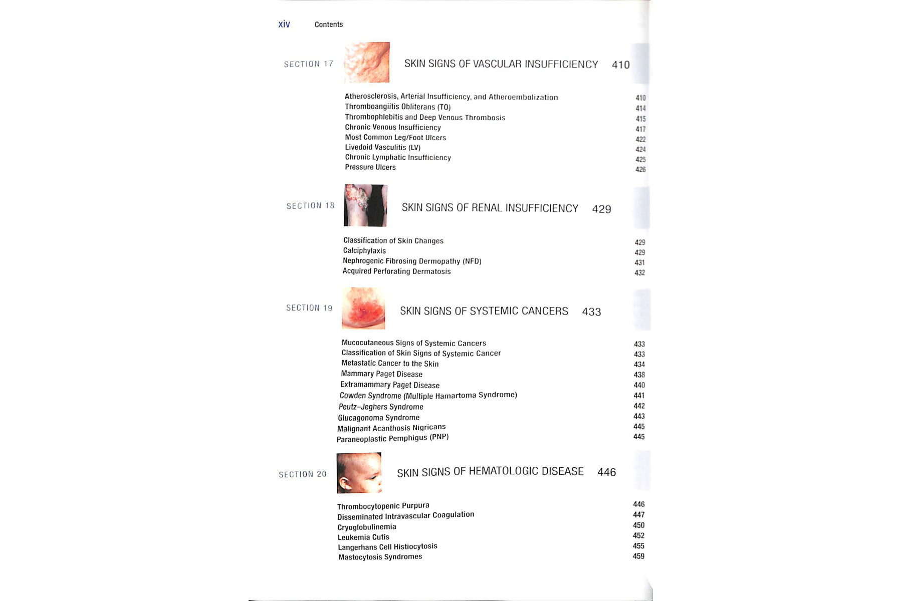 Fitzpatrick's Color Atlas and Synopsis of Clinical Dermatology, Seventh Edition