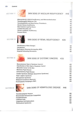 Fitzpatrick's Color Atlas and Synopsis of Clinical Dermatology, Seventh Edition