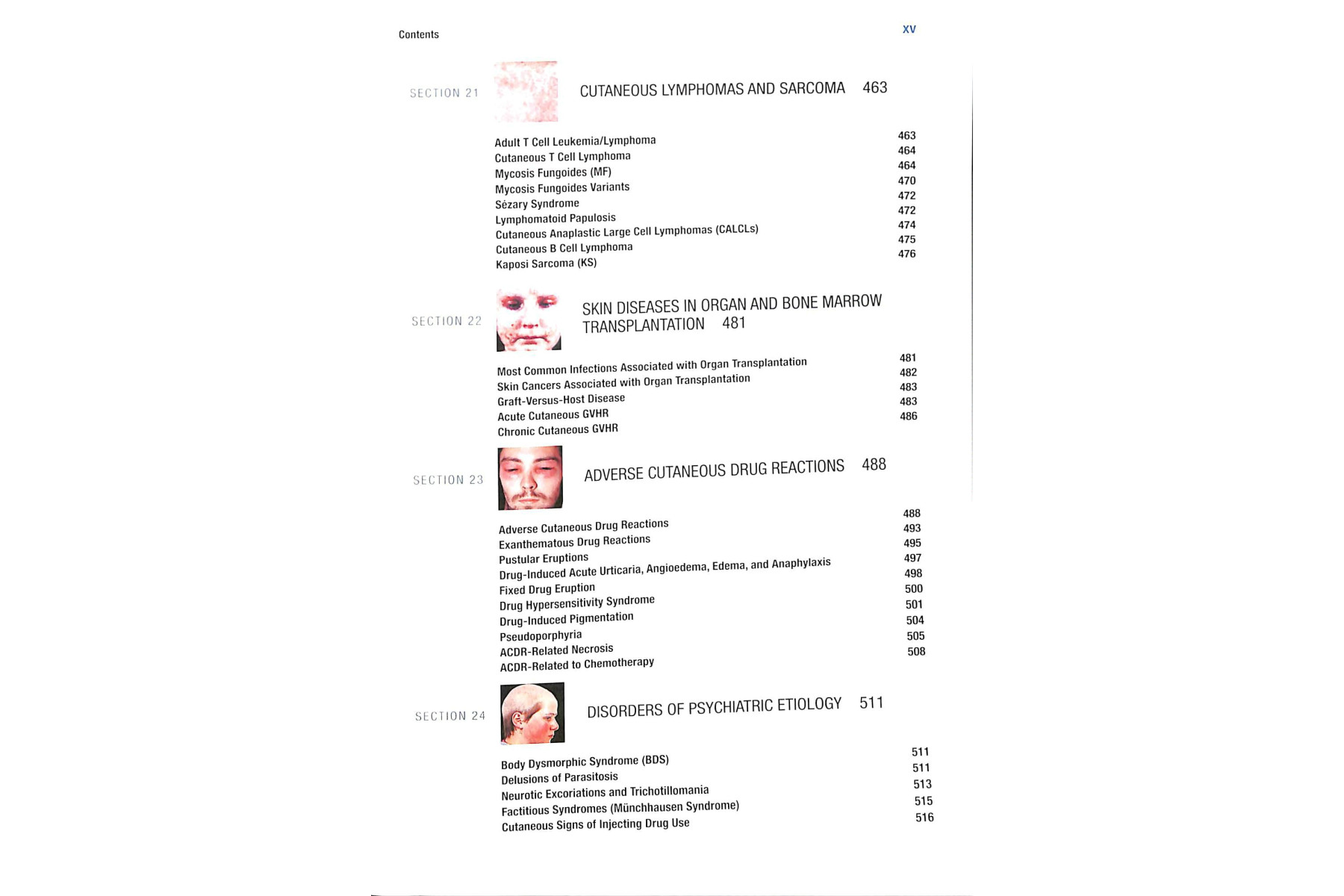 Fitzpatrick's Color Atlas and Synopsis of Clinical Dermatology, Seventh Edition
