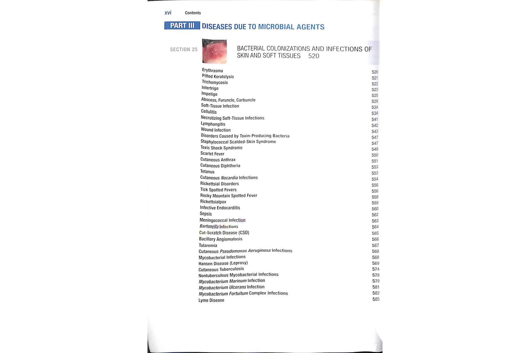 Fitzpatrick's Color Atlas and Synopsis of Clinical Dermatology, Seventh Edition