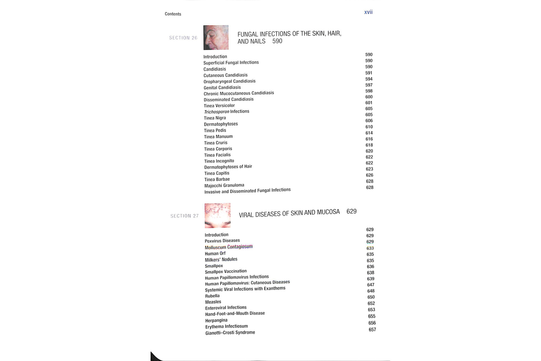 Fitzpatrick's Color Atlas and Synopsis of Clinical Dermatology, Seventh Edition