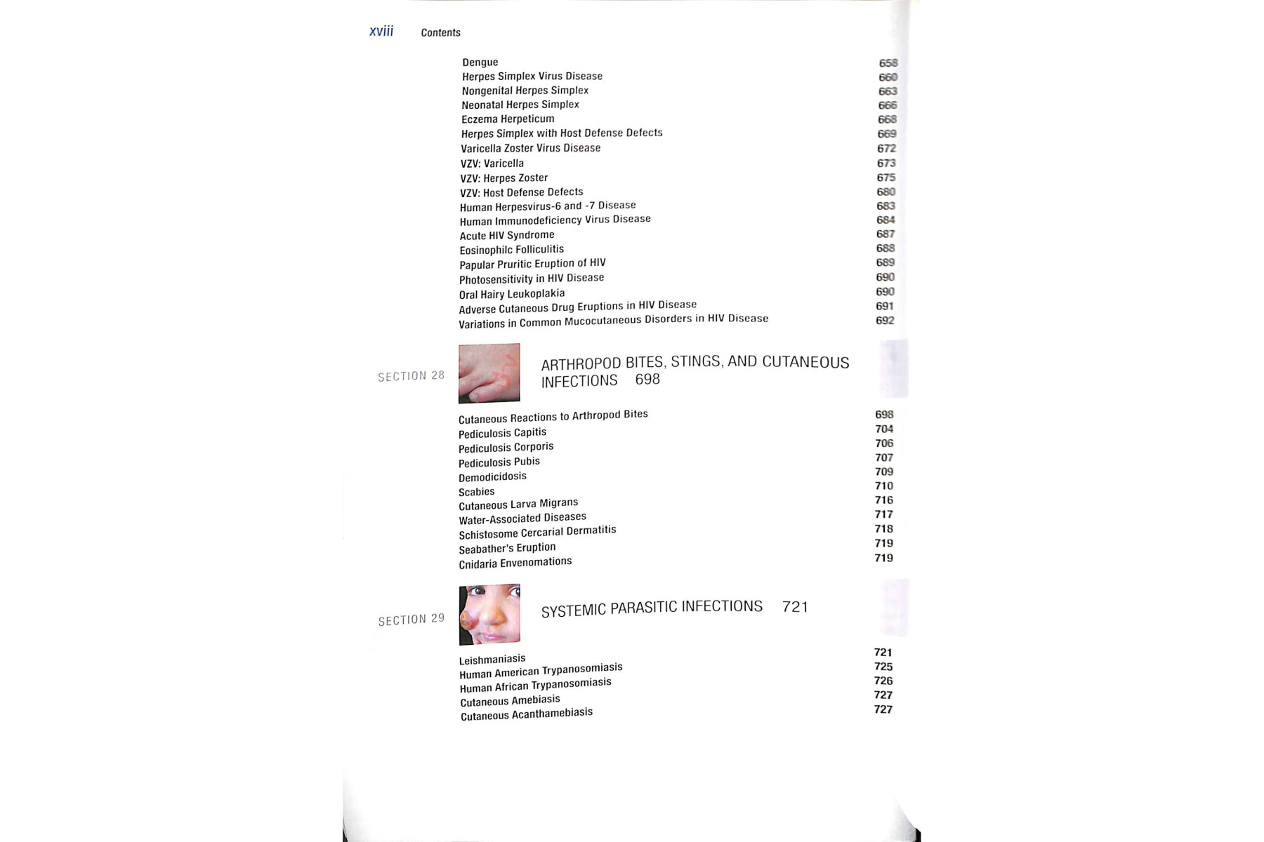Fitzpatrick's Color Atlas and Synopsis of Clinical Dermatology, Seventh Edition