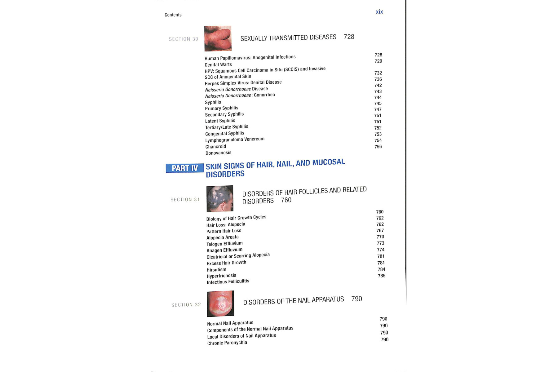 Fitzpatrick's Color Atlas and Synopsis of Clinical Dermatology, Seventh Edition