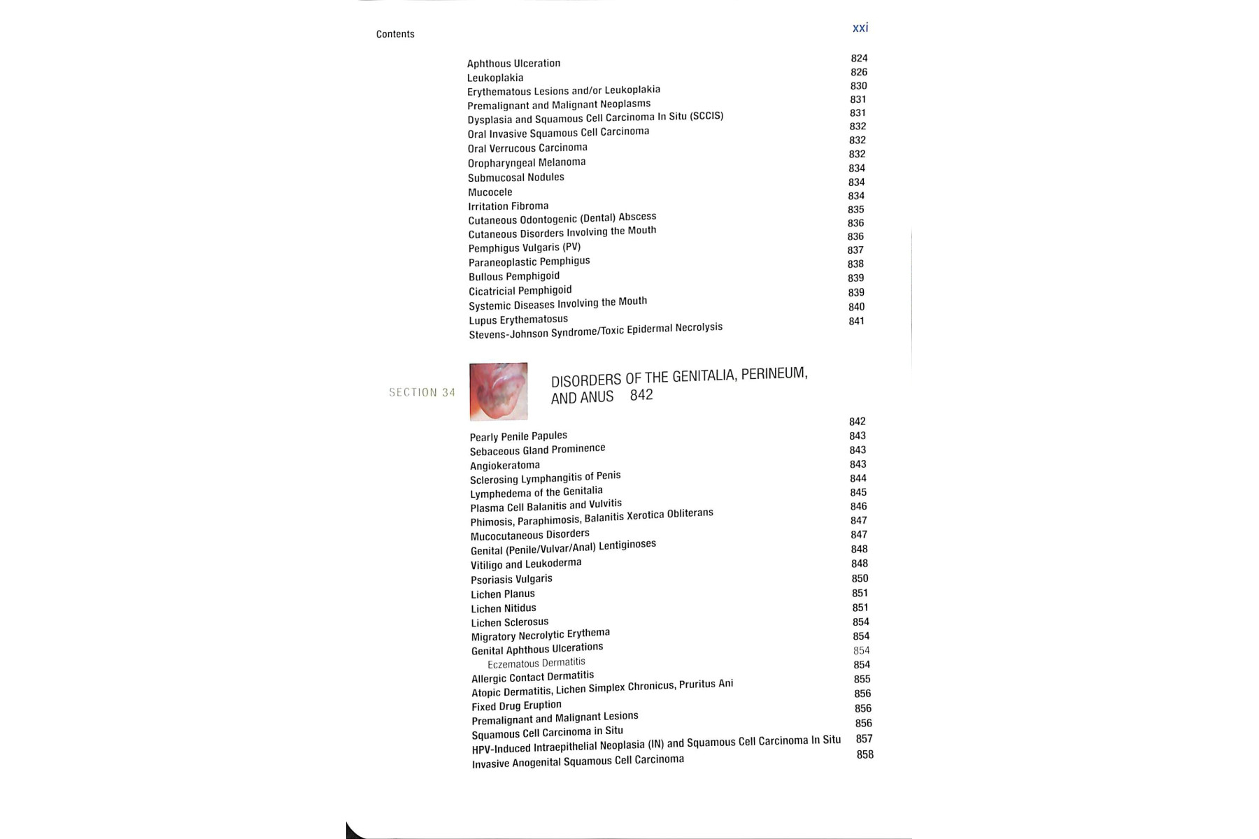 Fitzpatrick's Color Atlas and Synopsis of Clinical Dermatology, Seventh Edition