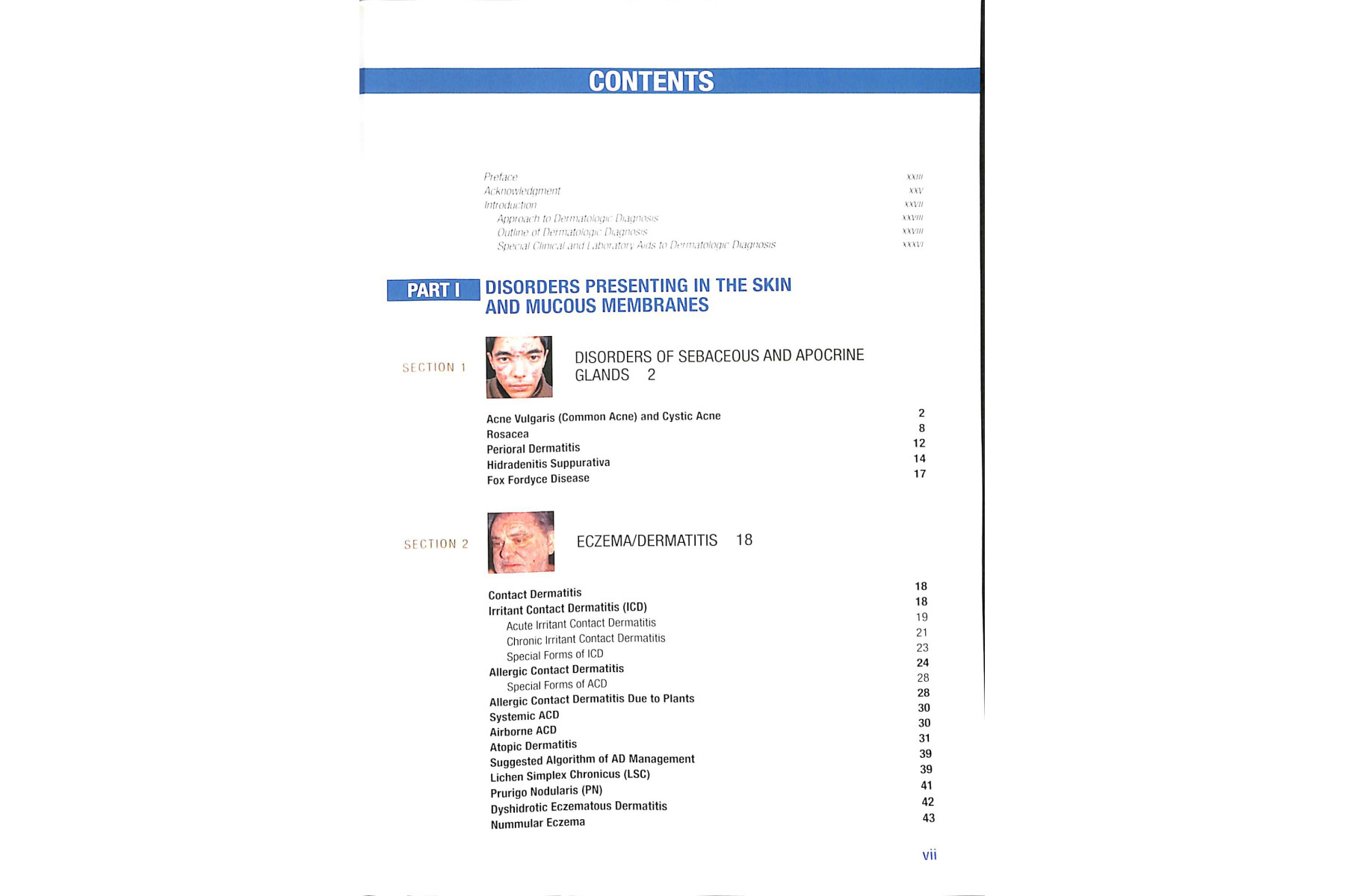 Fitzpatrick's Color Atlas and Synopsis of Clinical Dermatology, Seventh Edition