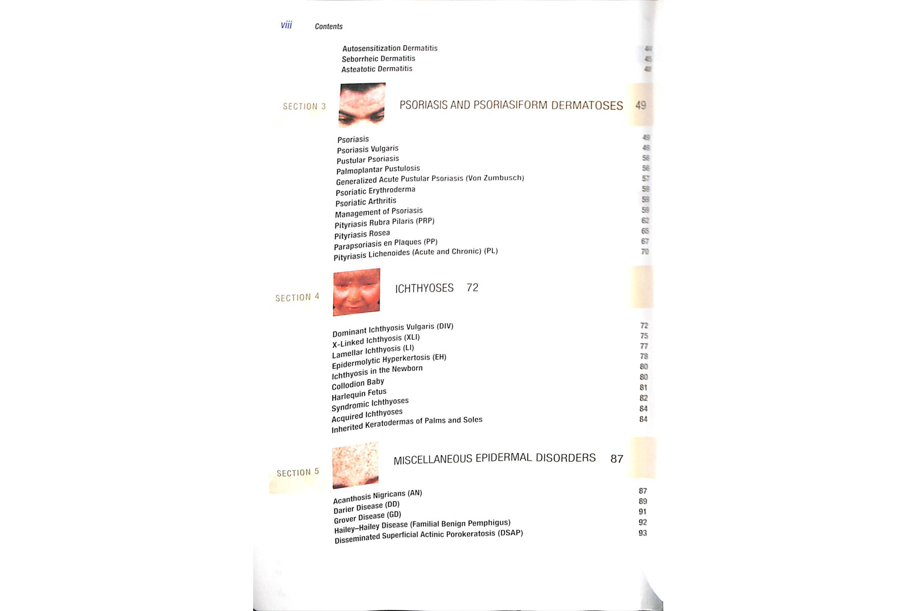 Fitzpatrick's Color Atlas and Synopsis of Clinical Dermatology, Seventh Edition