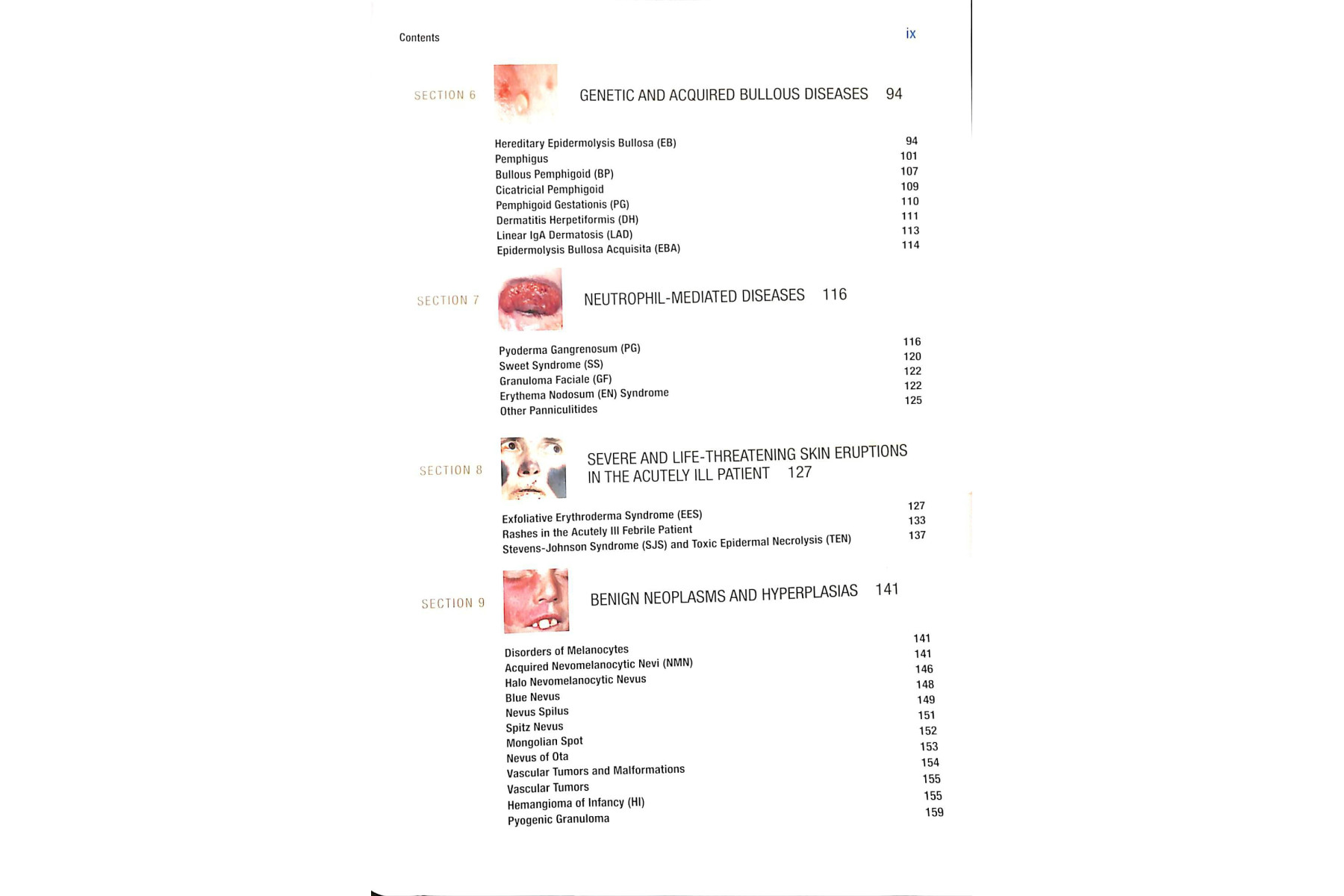 Fitzpatrick's Color Atlas and Synopsis of Clinical Dermatology, Seventh Edition