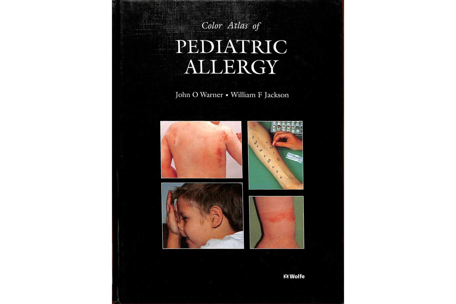 Color Atlas of Pediatric Allergy
