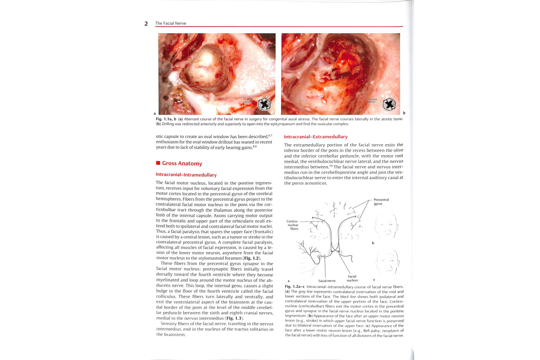 The Facial Nerve