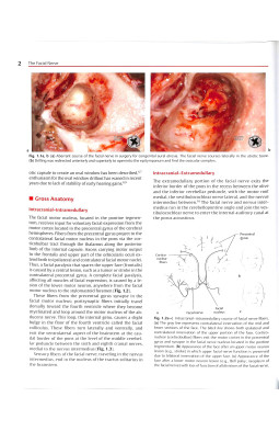 The Facial Nerve