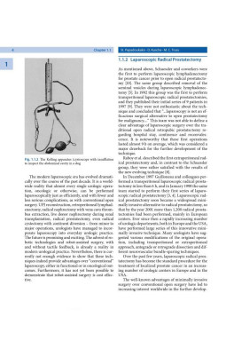 Endoscopic Extraperitoneal Radical Prostatectomy: Laparoscopic and Robot-Assisted Surgery